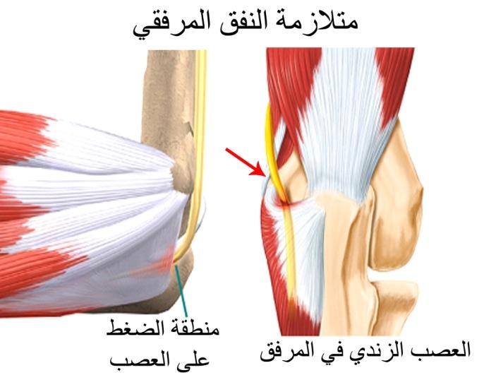 E:\Documents and Settings\USER\Desktop\كبار السن\متلازمة النفق المرفقي.jpg