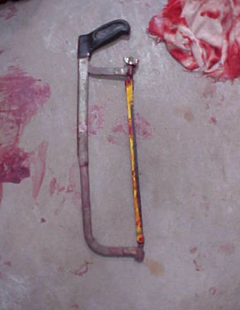 The saw used in dismembering Kuhn