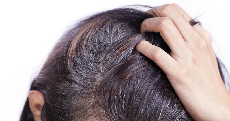 Nguyên nhân tóc bạc sớm ở nữ giới