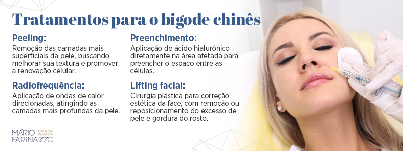 Tratamentos para o bigode chinês. Peeling: remoção das camadas mais superficiais da pele, buscando melhorar sua textura e promover a renovação celular. Radiofrequência: aplicação de ondas de calor direcionadas, atingindo as camadas mais profundas da pele. Preenchimento: aplicação de ácido hialurônico diretamente na área afetada para preencher o espaço entre as células. Lifting facial: cirurgia plástica para correção estética da face com remoção ou reposicionamento do excesso de pele e gordura do rosto.