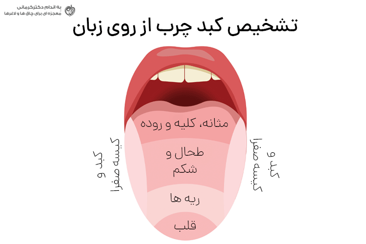 راه های تشخیص کبد چرب چیست؟ 3 روش کلی آزمایش خون، سونوگرافی و در منزل - 2 - تشخیص کبد چرب - کبد چرب