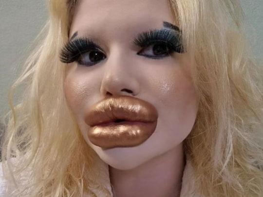 https://images.news18.com/ibnkhabar/uploads/2023/06/woman-with-biggest-lips.jpg?im=Resize,width=540,aspect=fit,type=normal