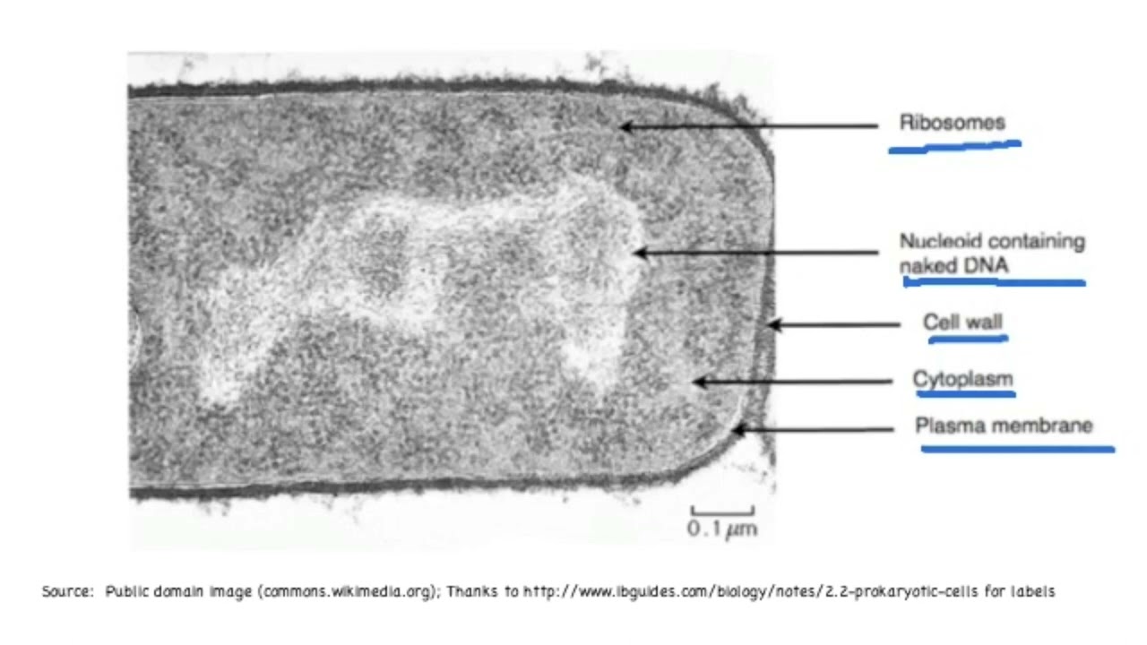 A2.2.10 Identifying parts of prokaryotic cells in electron micrographs -  YouTube