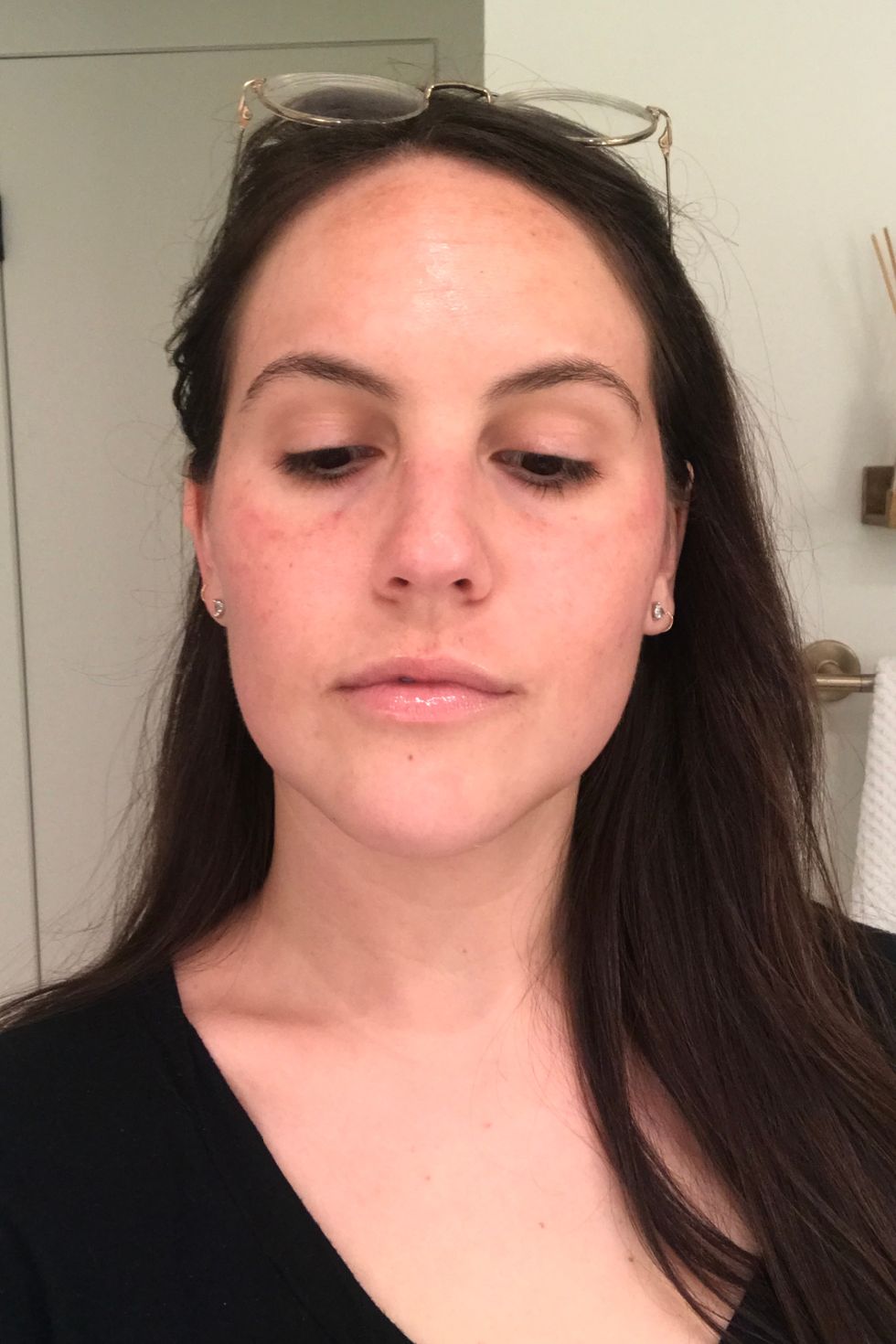 Day 4 of Pro Facial