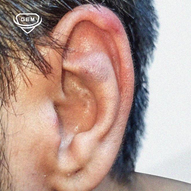 Close up of a person's ear

Description automatically generated