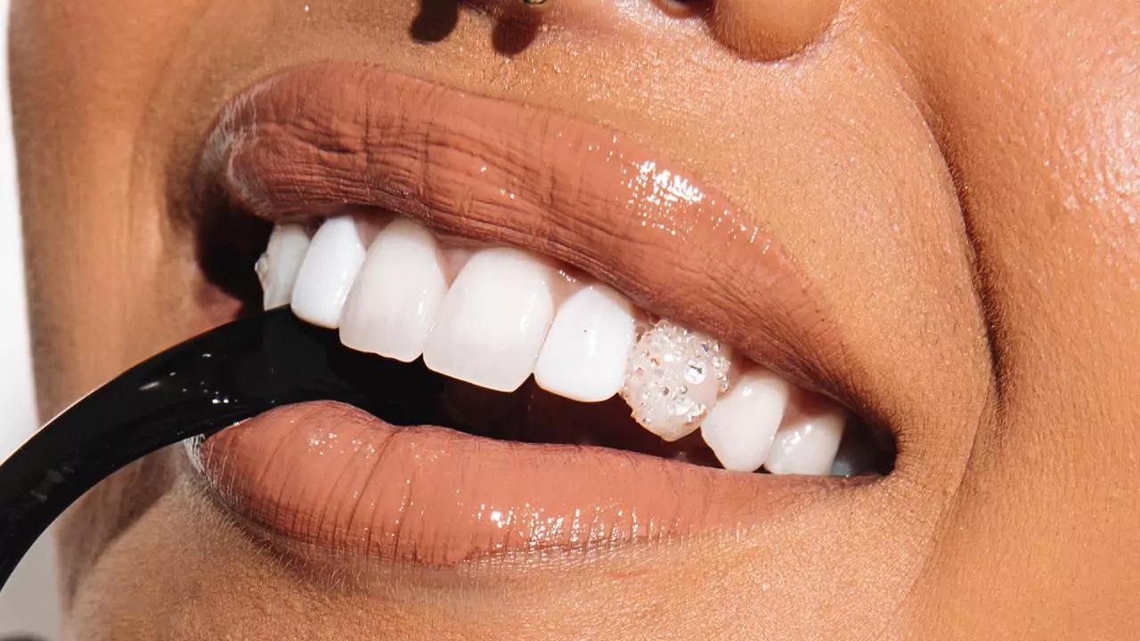 Full view of a dentition rocking the stylish tooth gems 