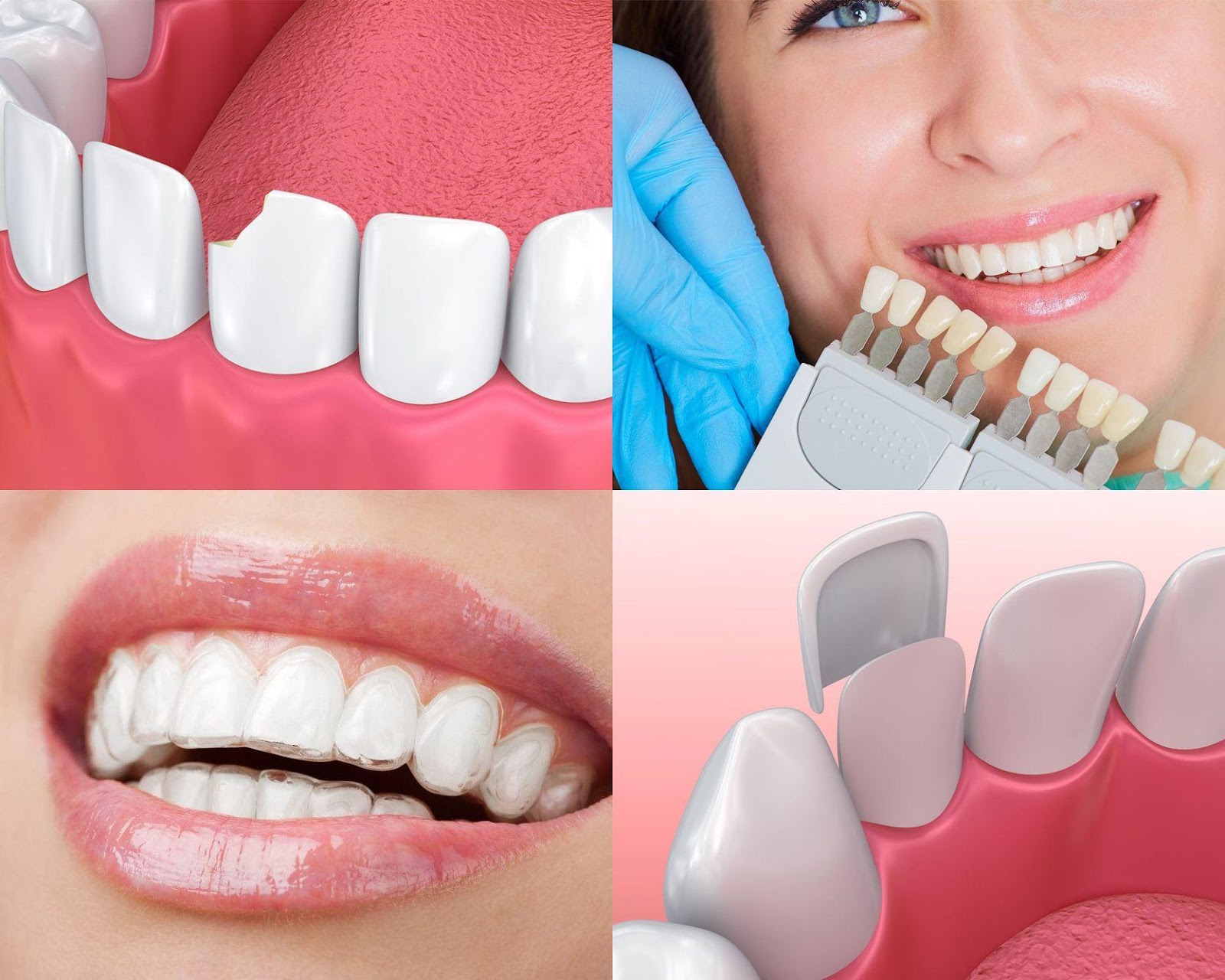 cosmetic dentistry in North York