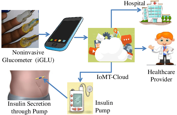 iGLU (Intelligent Glucose Meter) IoMT