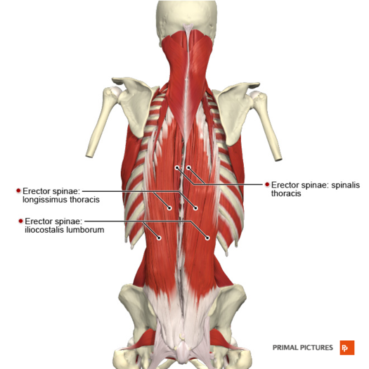 Lumbar Strain