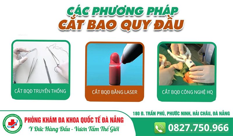 các phương pháp cắt bao quy đầu