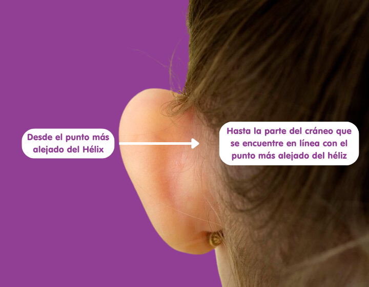 Método de colocación Otostick -corrector estético para orejas