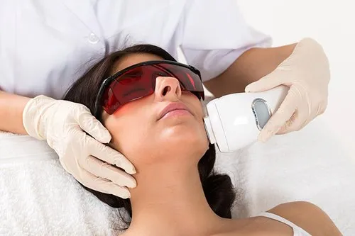  Picture showing a lady undergoing a laser treatment on her face