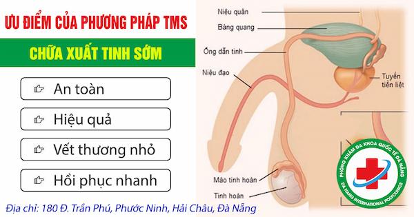 Ưu điểm của phương pháp TMS