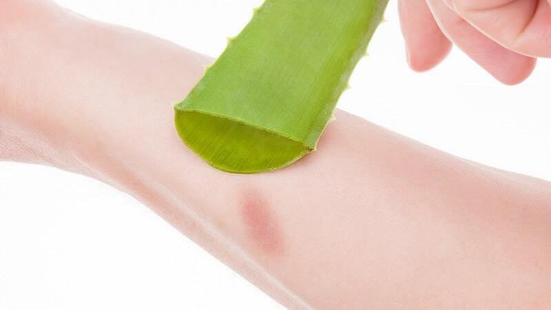 Aloe vera có tác dụng ức chế đau hiệu quả