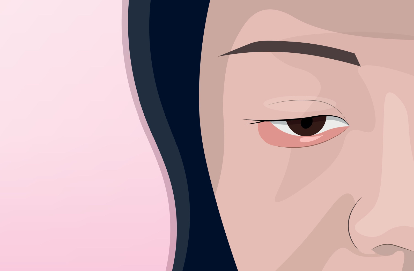 A digital image portraying a close-up view of a woman's face and eye with meibomian gland dysfunction present on her eyelid