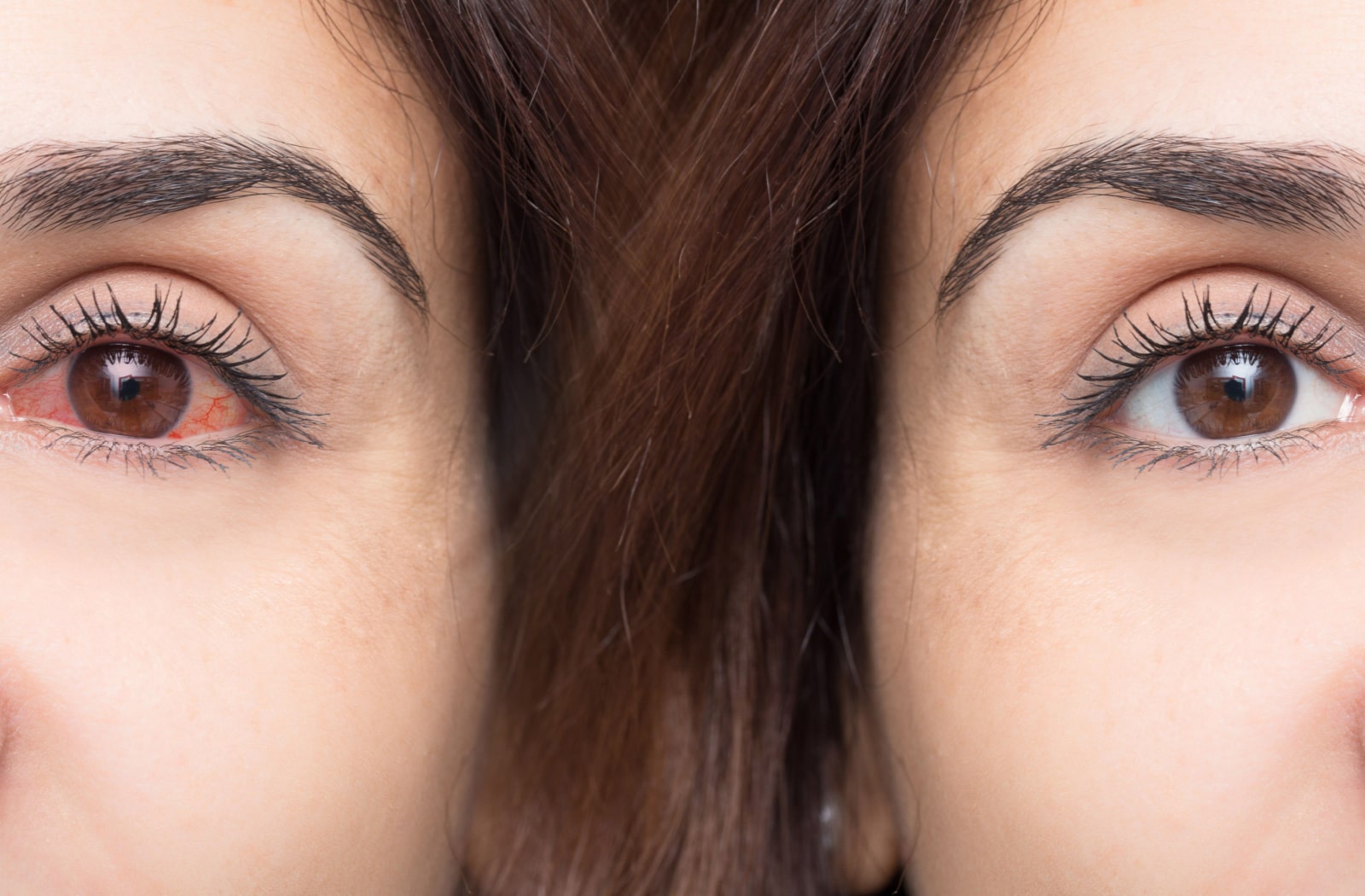 A woman's clear and healthy eye on the right and next to her on the left is a woman with a dry and red eye