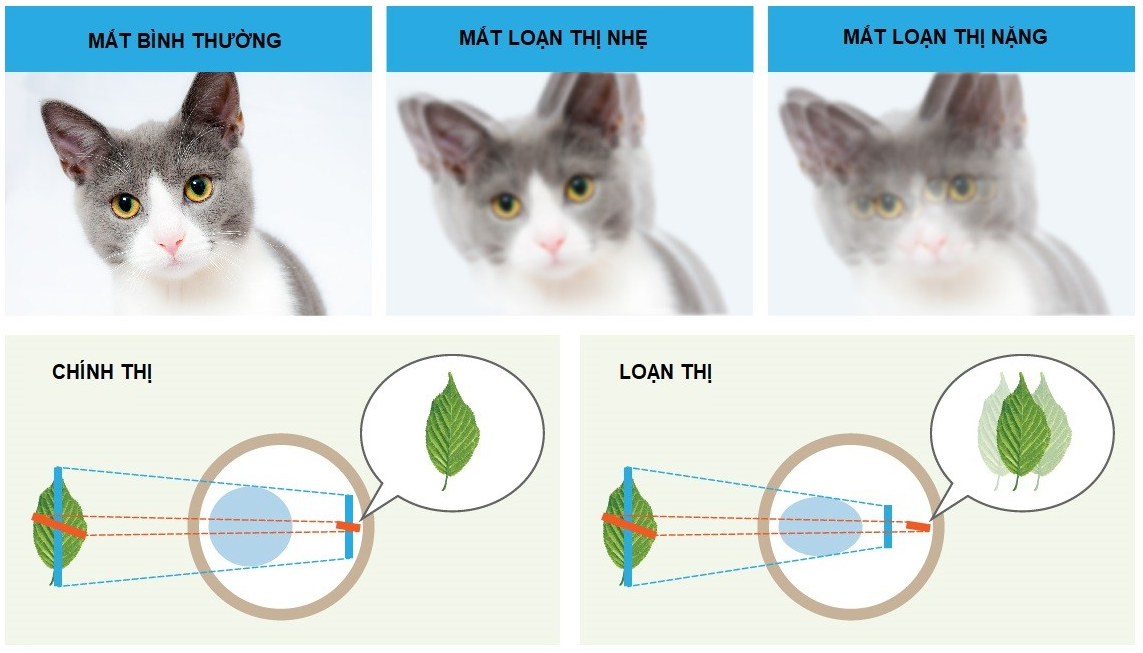 loan-thi