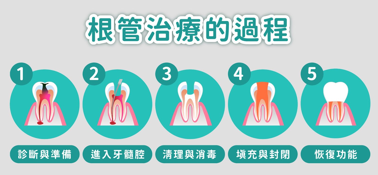 判斷是否需要根管治療是一個複雜的過程，涉及臨床症狀、檢查結果以及影像學評估。如果牙髓感染或壞死，根管治療通常是拯救牙齒的最佳選擇。