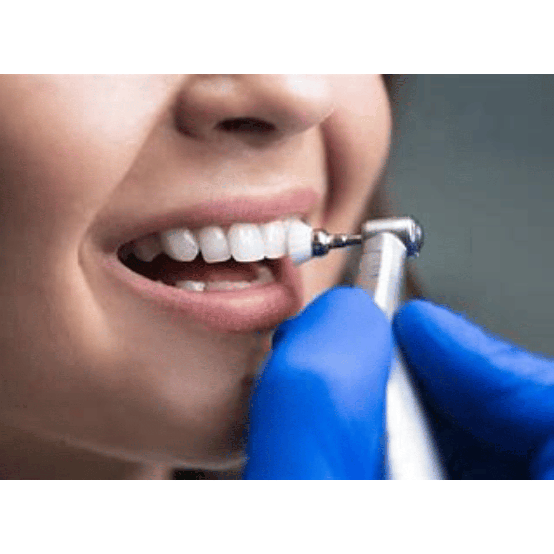 How Much is a Dental Cleaning Without Insurance