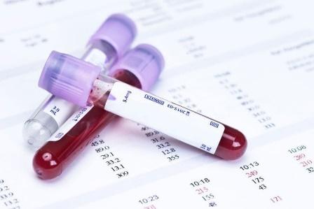 Ý nghĩa các chỉ số trong xét nghiệm máu | Vinmec