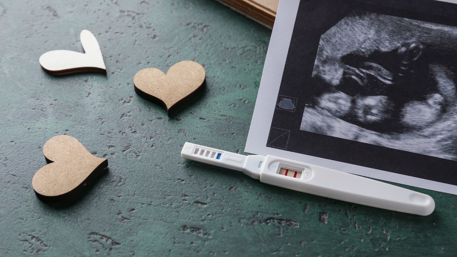 妊娠検査薬の使用タイミング完全ガイド: いつからが最適？