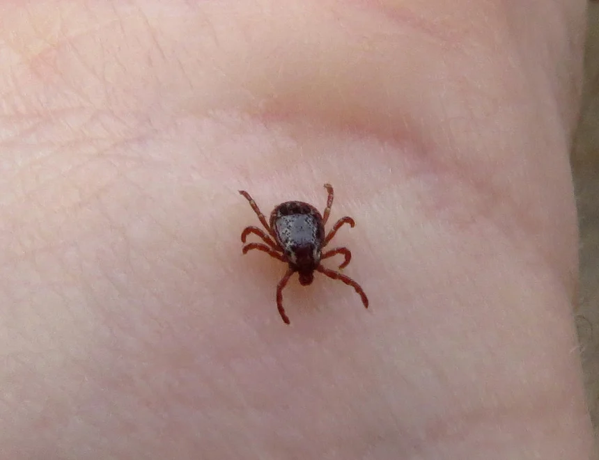 Photo of a human hand with a tick on its palm.