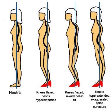 Pro-Fit Personal Training Is Wearing High Heels Causing Your Knee And/or Back Pain? ?? If You Are One To Wear High Heels Regularly And Suffer From Knee And/or Back Pain, You |