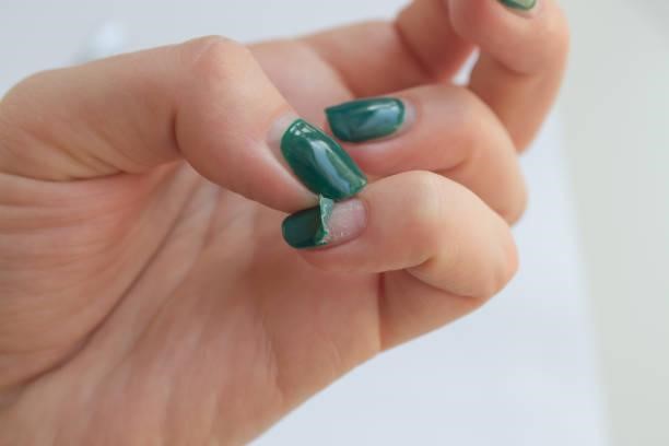 Damaged female nail with green manicure. Peeled off gel polish with nails. Home manicure concept Damaged female nail with green manicure. Peeled off gel polish with nails. Home manicure concept. damaged manicure stock pictures, royalty-free photos & images