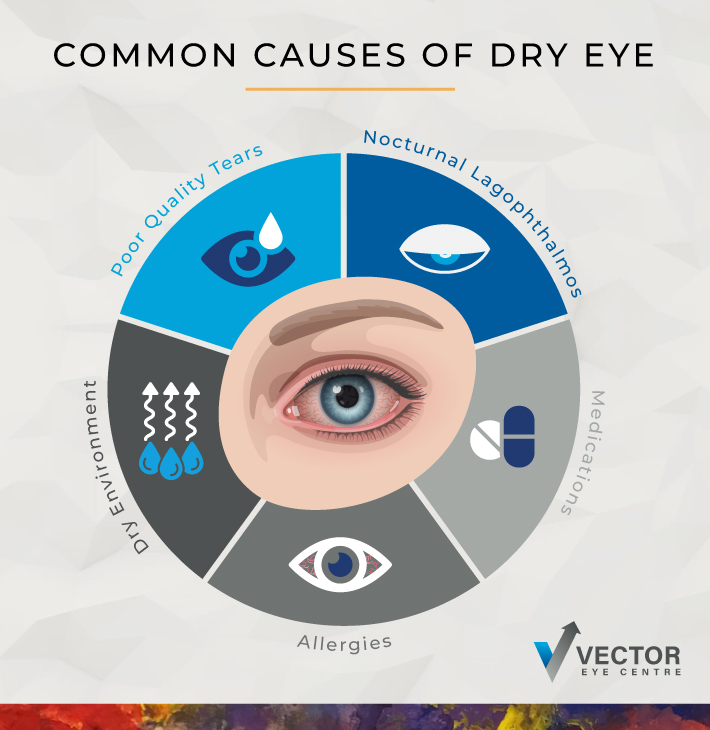 An infographic highlighting the common causes of dry eye.