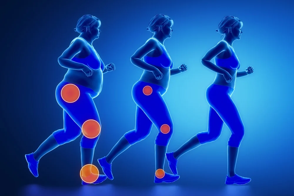Benefits of Exercise for Rheumatoid Arthritis Patients with Obesity