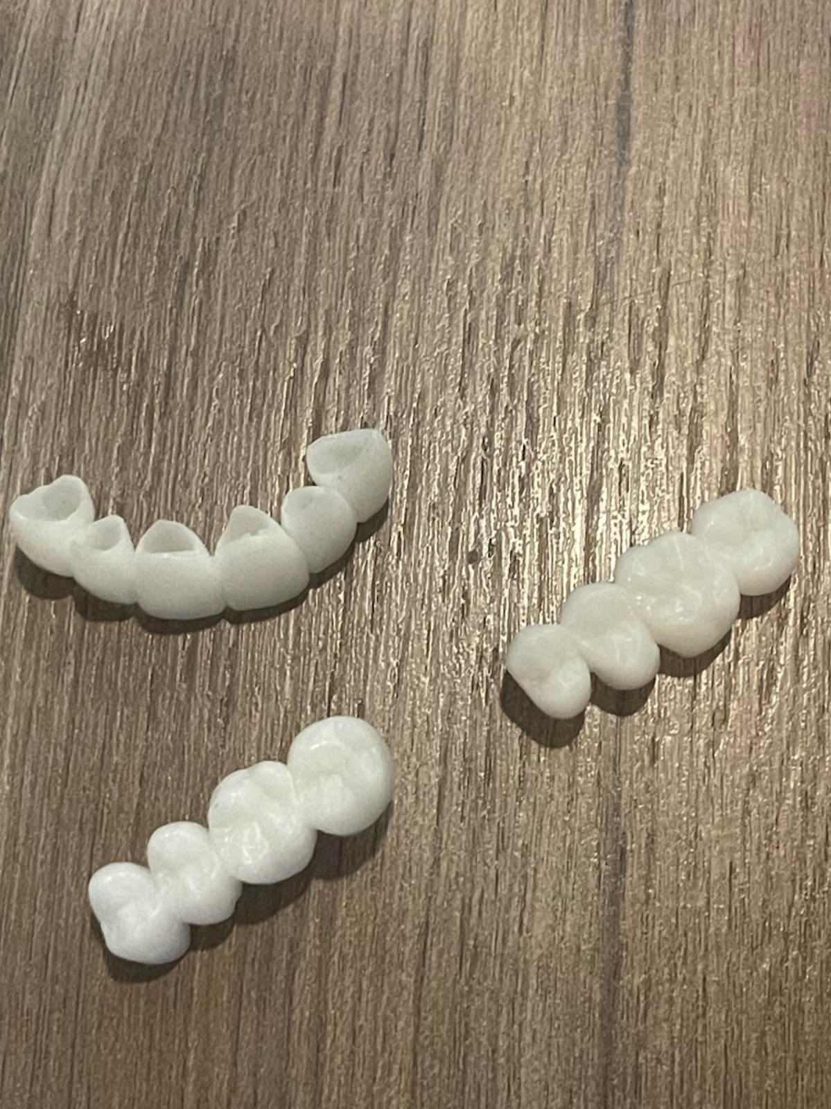 Temporary teeth