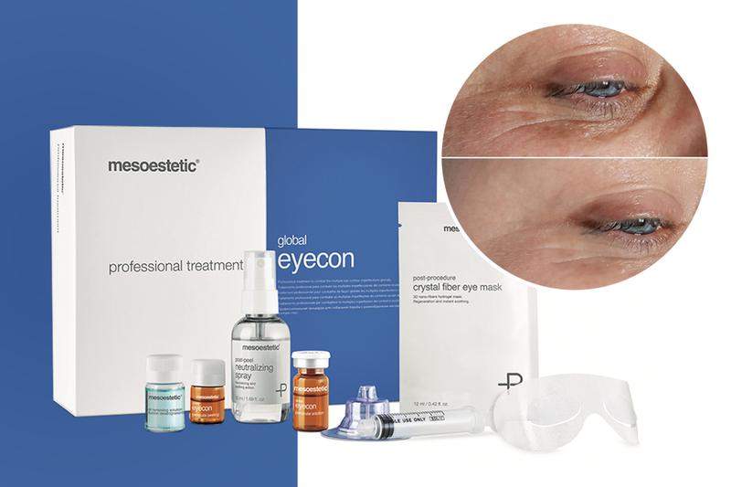 ¿Qué es el tratamiento Global EyeCon?