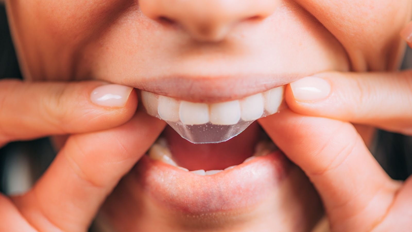 woman applying teeth whitening strips