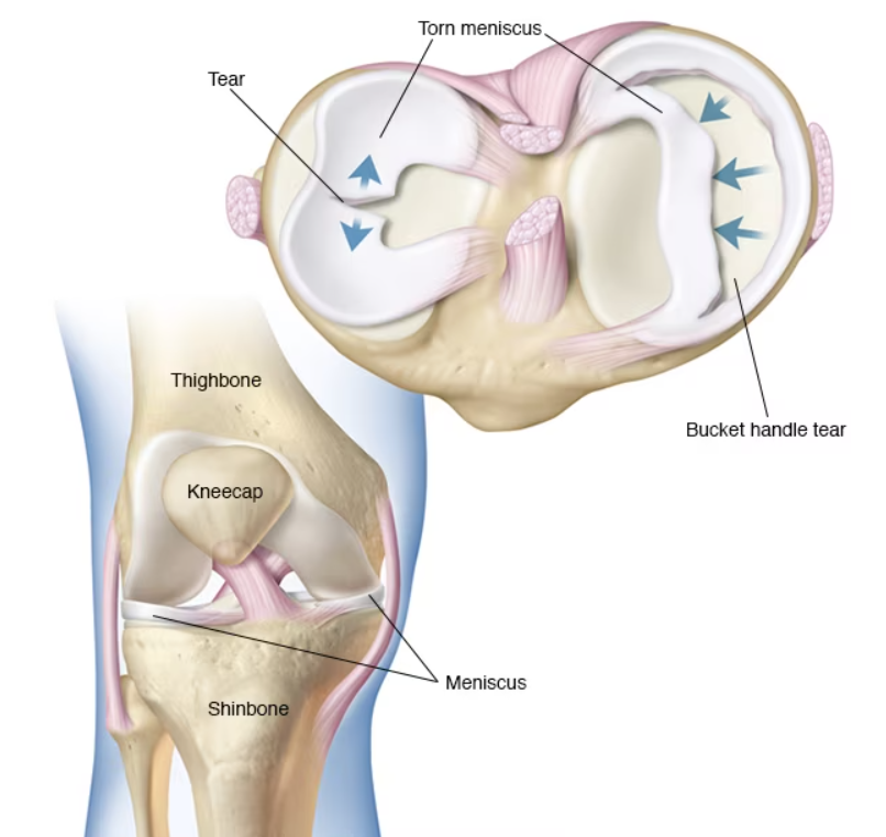 Knee Injuries