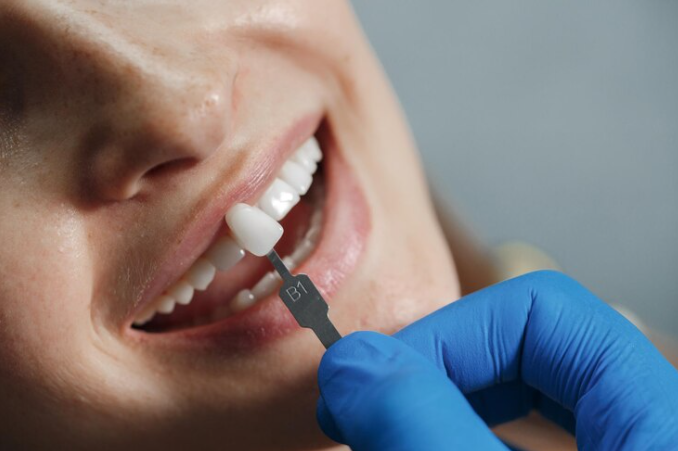 What is a Dental Crown, and How do You Find the Specialist For it?