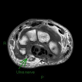 A close-up of a mri Description automatically generated