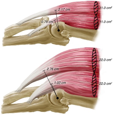 Biomechanical implications of skeletal muscle hypertrophy and atrophy ...