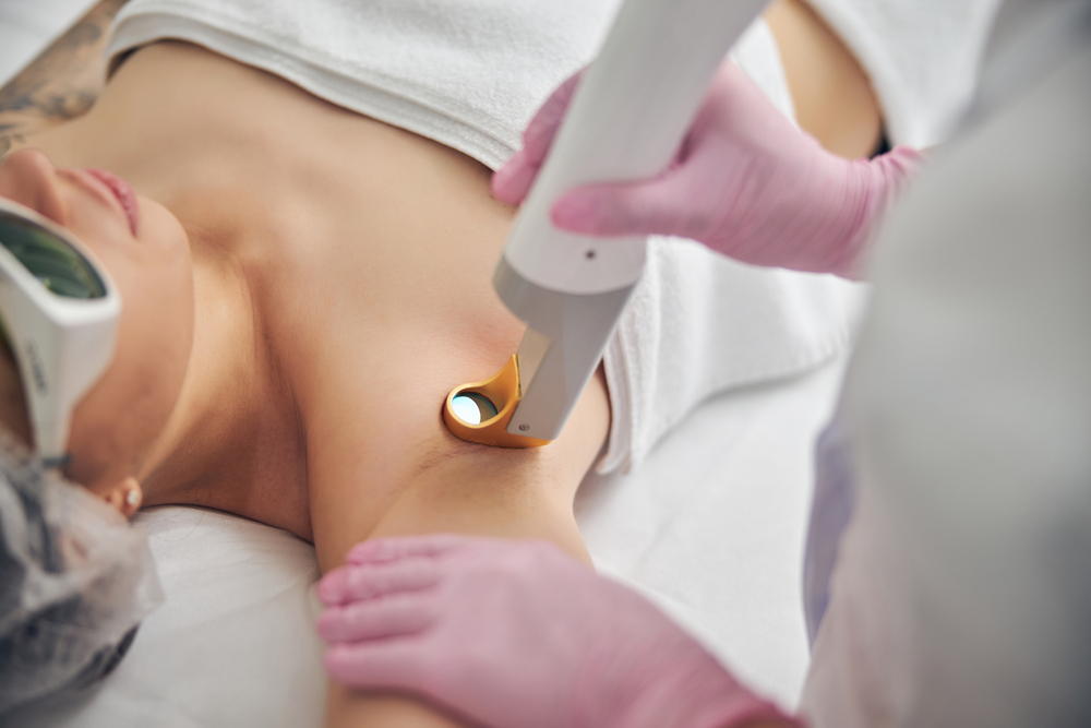 Laser Armpit Hair Removal