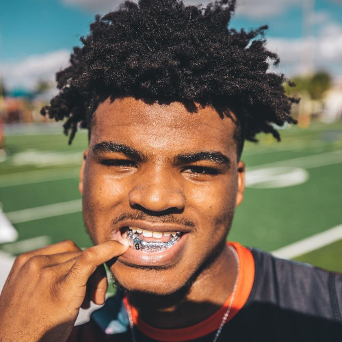 Young male football player pointing to his silver grillz mouthguard