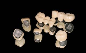 Tìm hiểu các loại răng sứ thịnh hành hiện nay và điểm mạnh, yếu của từng loại