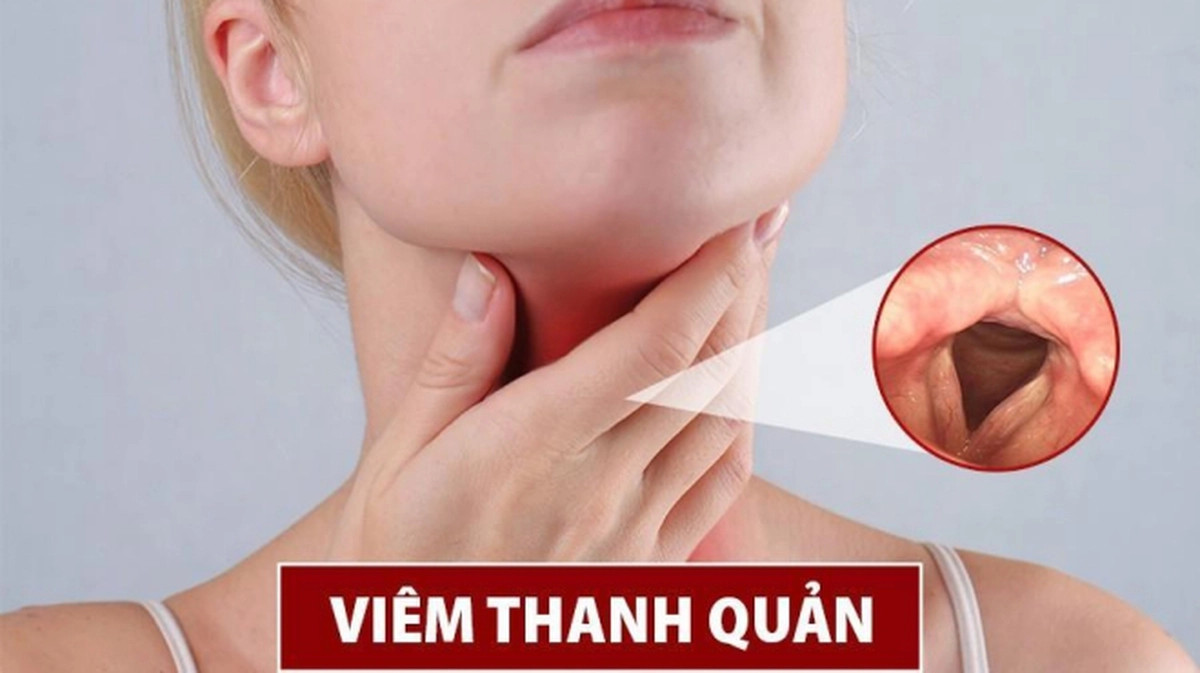 VIEM-THANH-QUAN