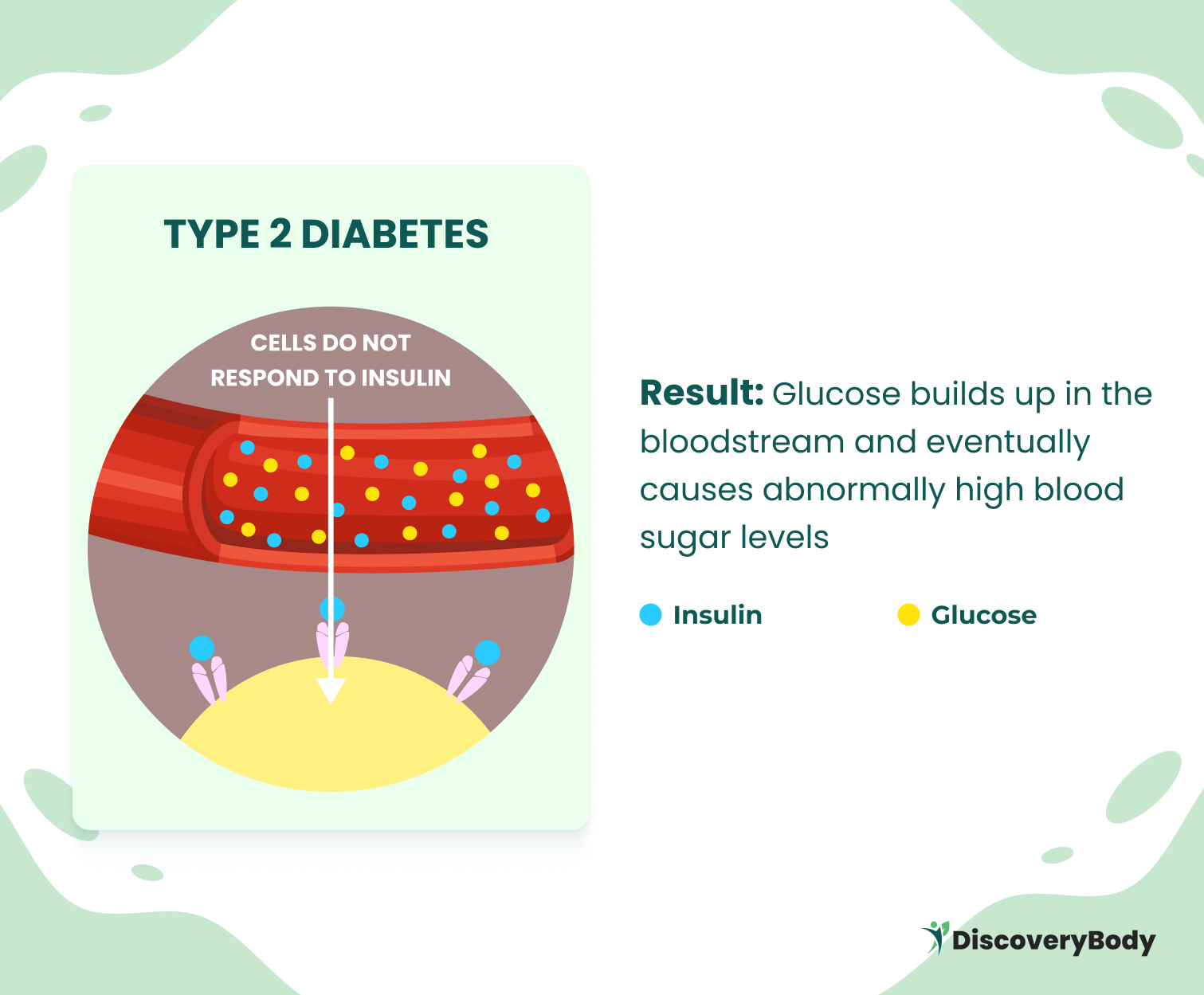 Unlike Type 1 diabetes, which is caused by an autoimmune attack on the pancreas resulting in a lack of insulin production, Type 2 diabetes occurs when the body either doesn't produce enough insulin or is unable to use it effectively