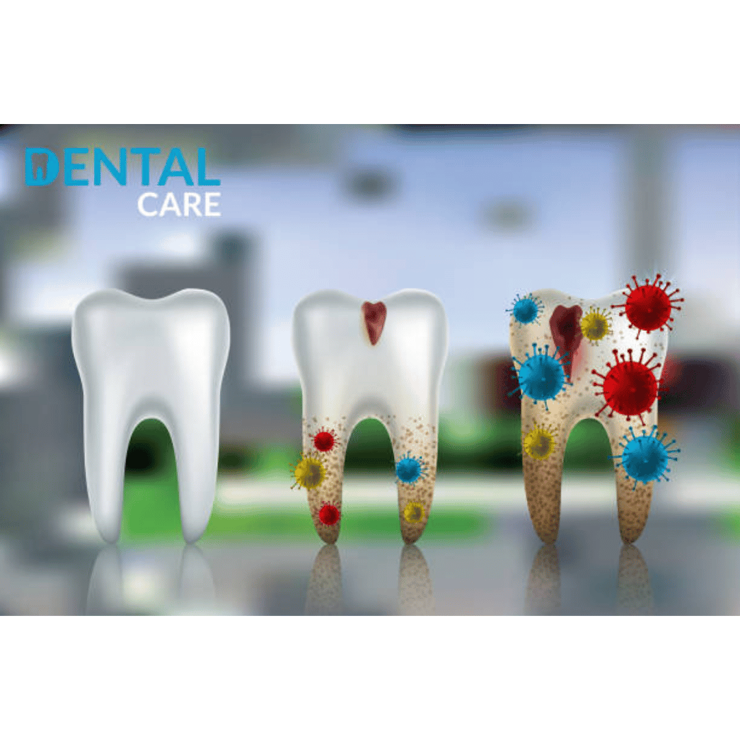 Teeth Sealants Pros and Cons