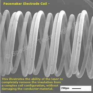 pacemaker_coil