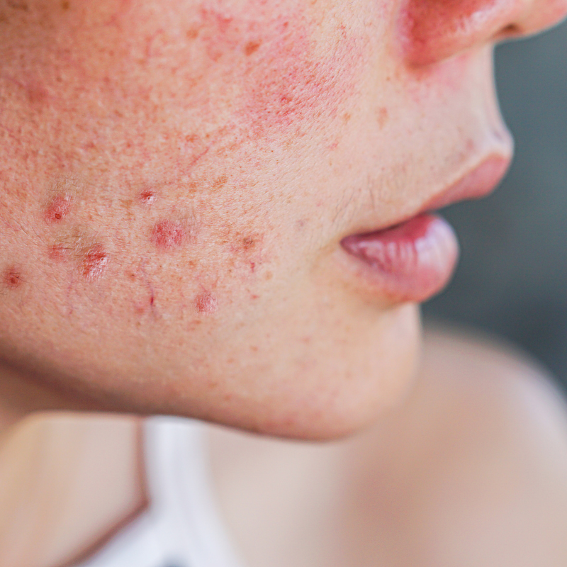 Visit a dermatologist if you notice an unusual rash on your skin