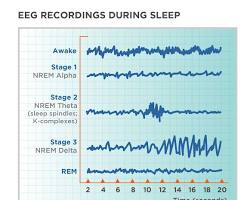 Image of Sleep stages brainwave activity