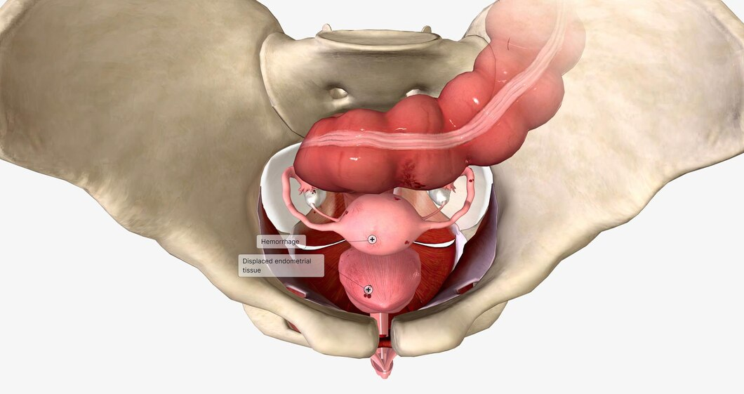 Rectal Prolapse