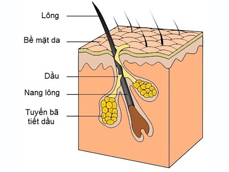 Nguyên nhân tạo ra sợi bã nhờn ở da