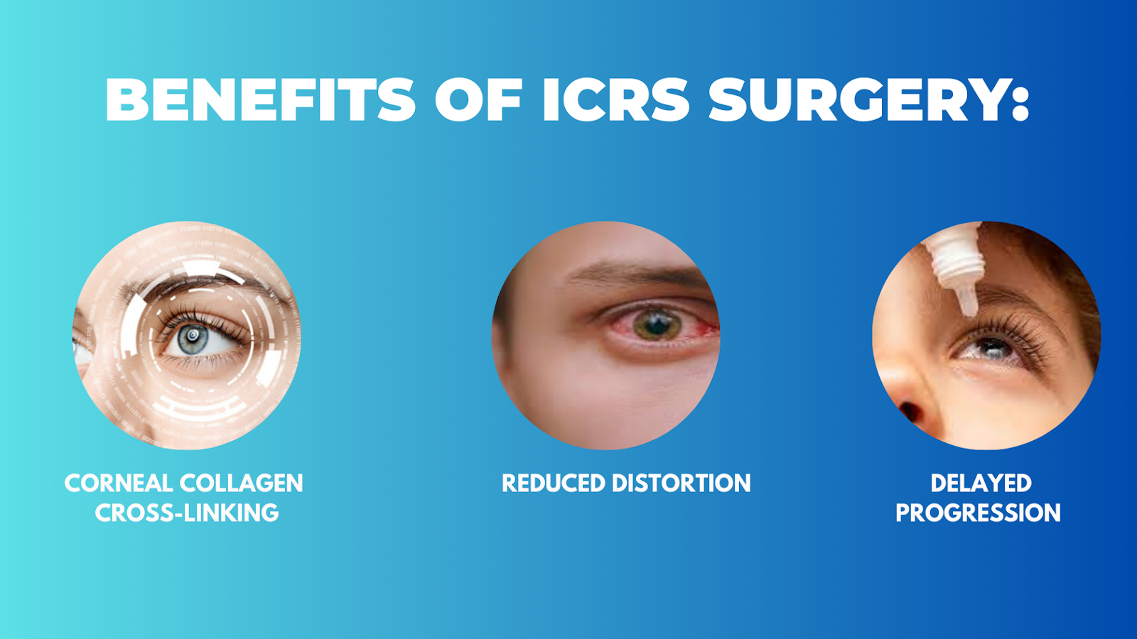 benefits-of-icrs-surgery
