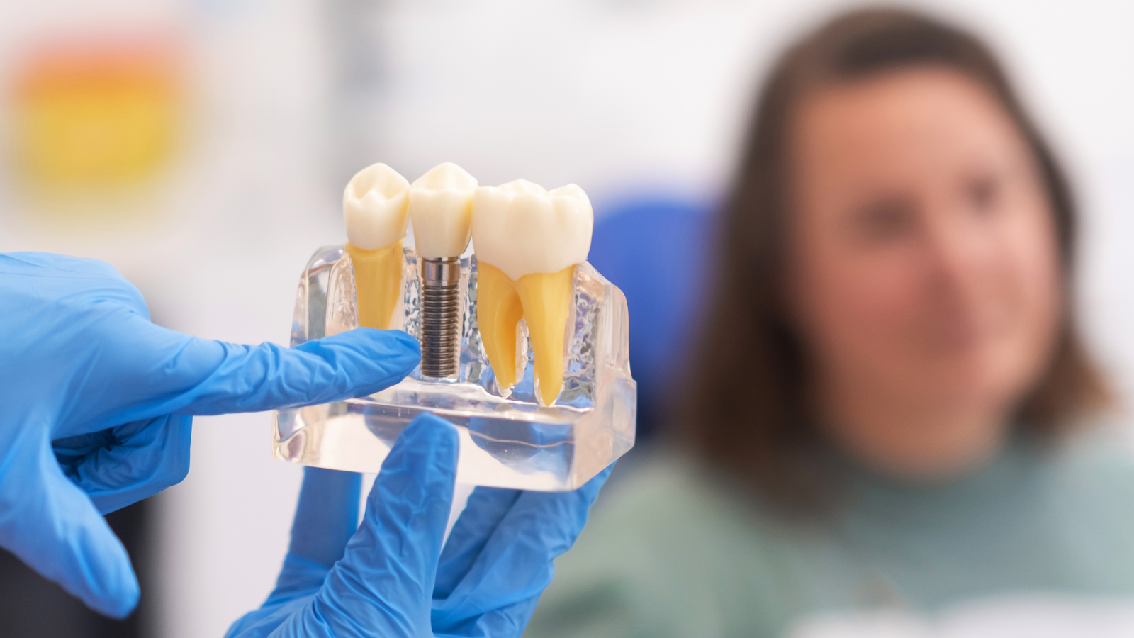 Dental Implant Marketing – Exploring the Discovery Process